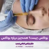 تزریق بوتاکس چیست؟ فواید بوتاکس صورت