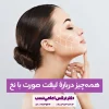 لیفت صورت با نخ در کلینیک زیبایی دکتر نرگس امامی نسب